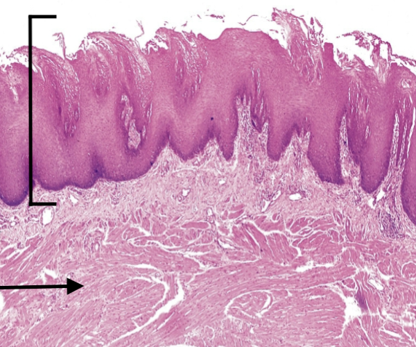 <p>What type of muscle is haphazardly arranged in this image of tongue?</p>