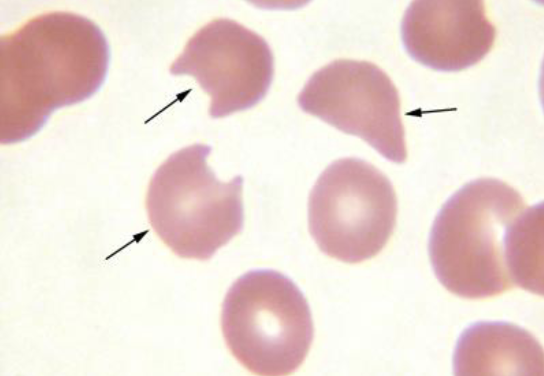 <p>Schistocyte </p>