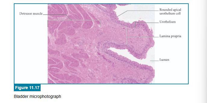<p>correct answers</p>