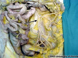 <p>what artery is pictured (context, loops of the small intestine have been removed)?</p>