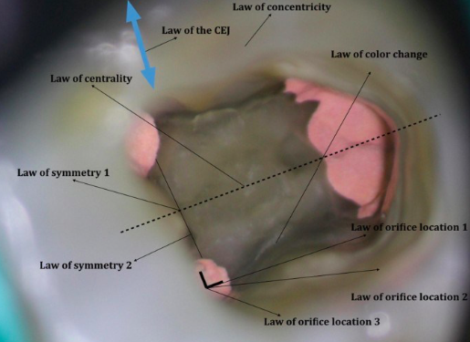 <p><span> </span><span style="color: red;"><span>distance</span></span><span> from the external surface of the clinical crown to the wall of the pulp chamber </span><span style="color: red;"><span>is the same throughout the circumference at the CEJ</span></span></p><p><em><span>making the CEJ the most consistent repeatable landmark for locating the position of the pulp chamber</span></em></p>