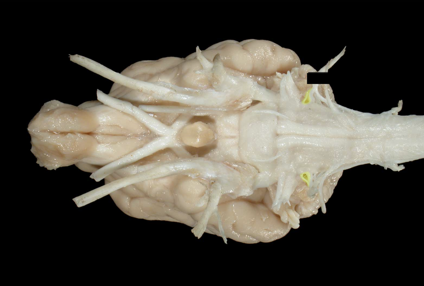 <p>what nerve is this</p>