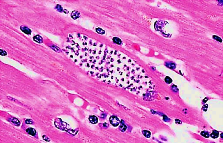 <p><span>Heart Tissue</span></p>