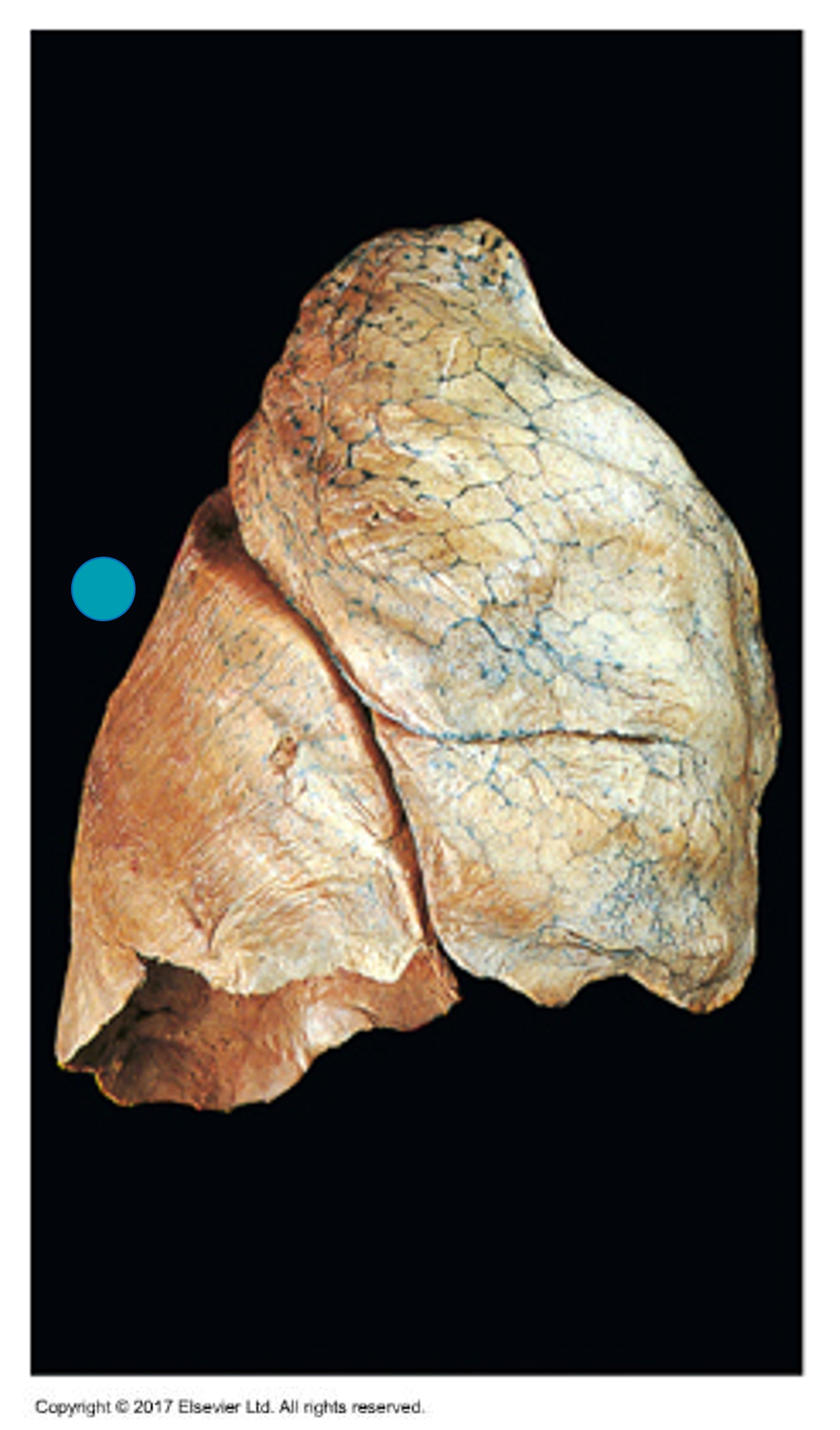 <p><span>The blue dot indicates the:</span></p>