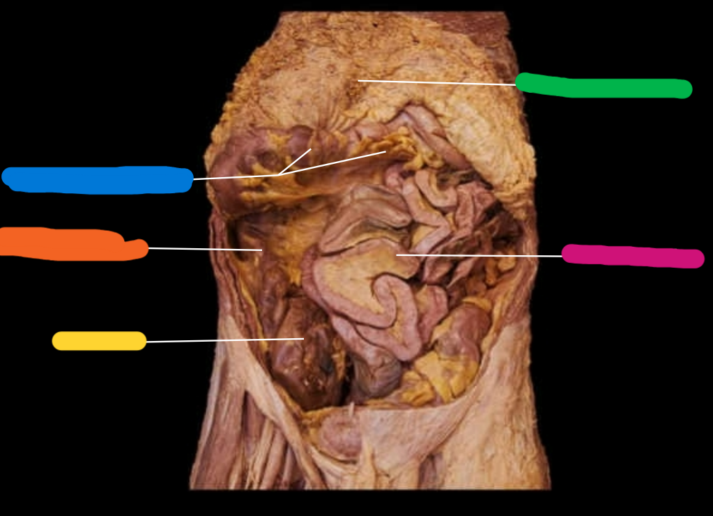 <p><span style="color: rgb(0, 0, 0);">Name the following features highlighted</span></p>