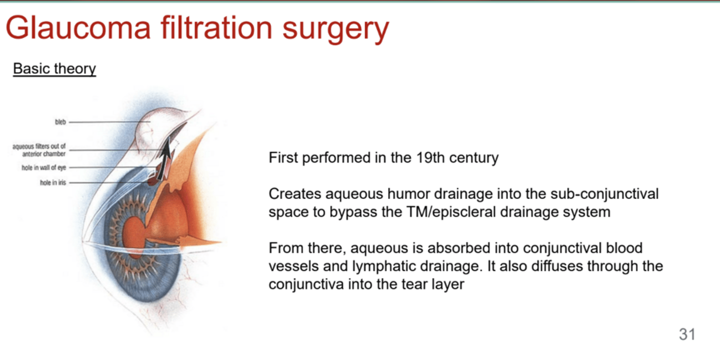 <p>When was glaucoma filtration surgery 1st performed?</p>