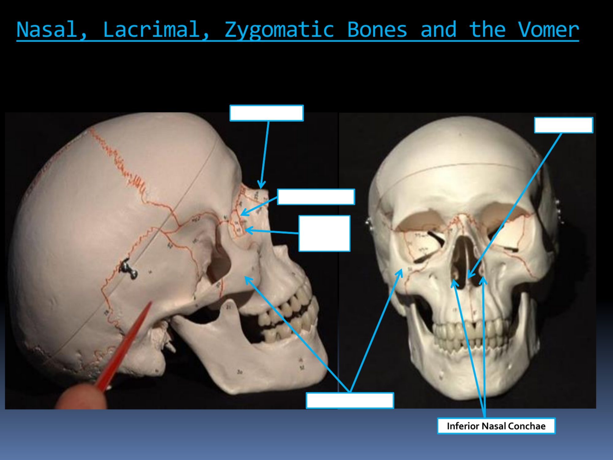 <p>Inferior Nasal Conchae</p>