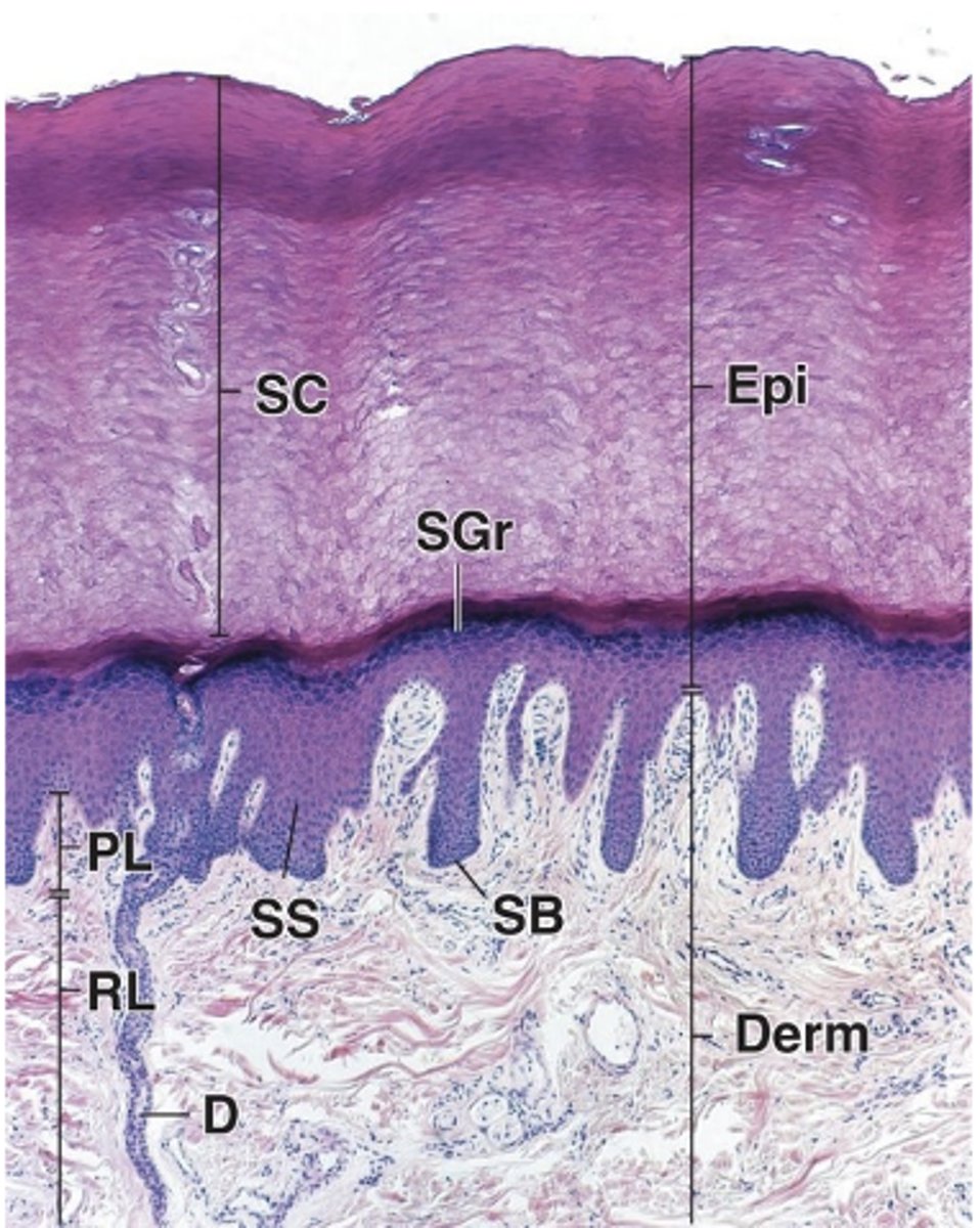 <p>Identify the type of skin</p>