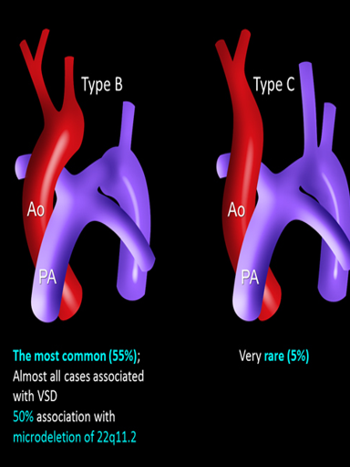 <p>type b and c in IAA </p>