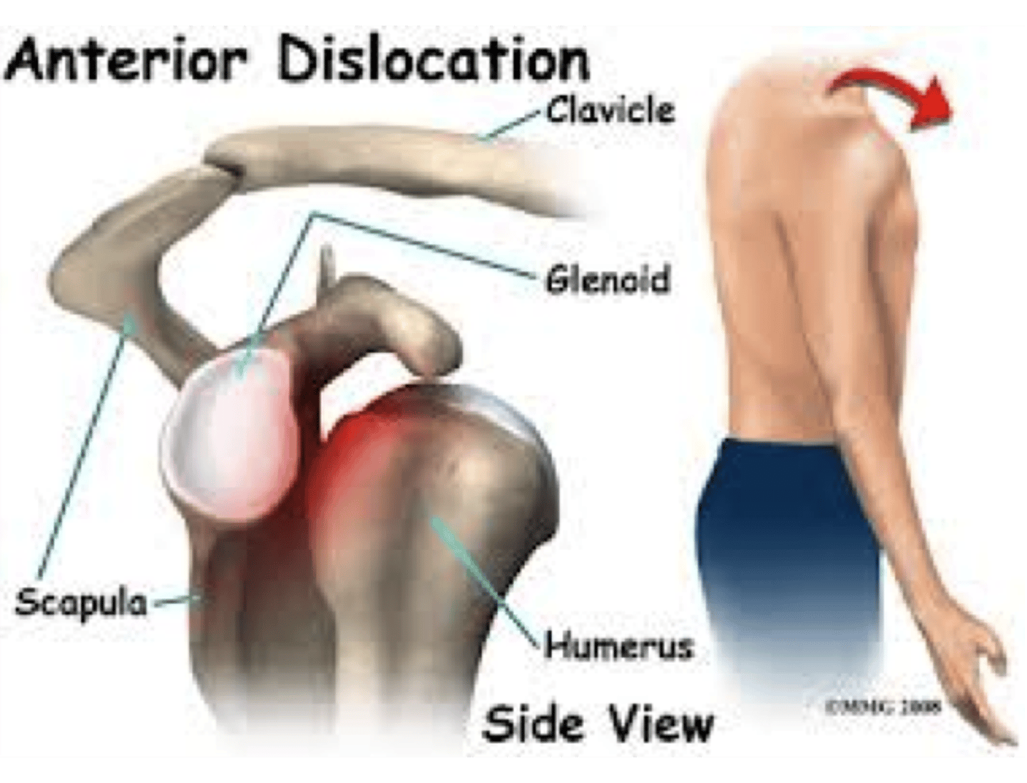 <p>combining excessive horizontal abduction and lateral rotation</p>
