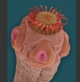 <p>What type of cestode is this?</p>