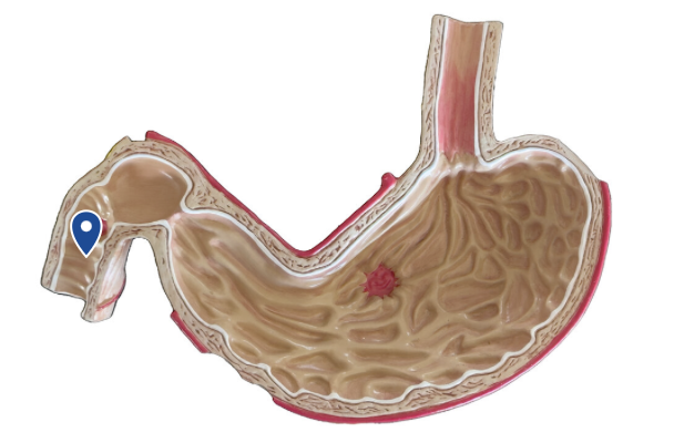<p>Name this segment of the small intestine.</p>