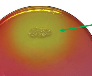 <p>test and result</p>