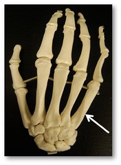 <p>Name this specific bone of the hand (posterior view).</p>