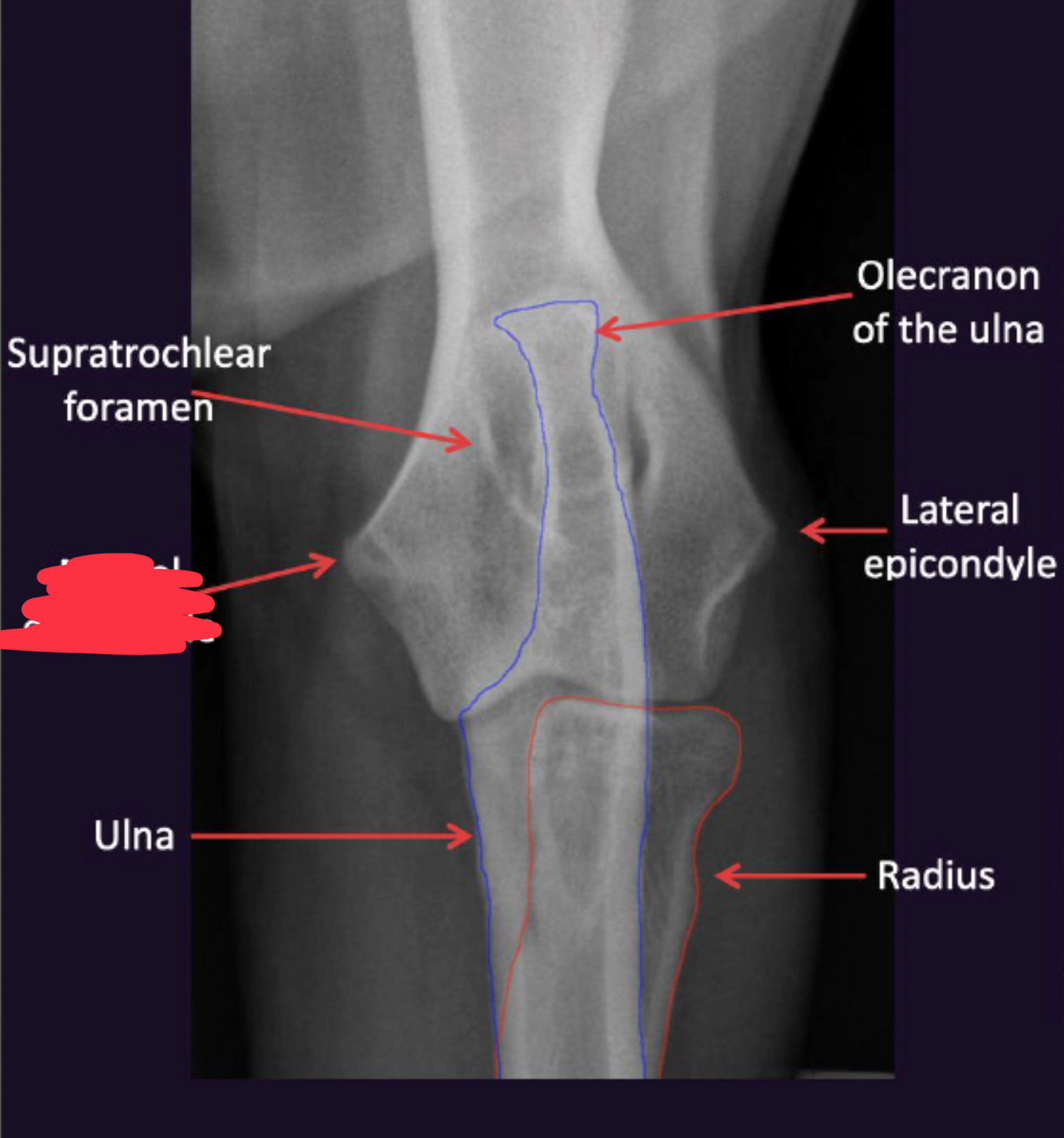 term image