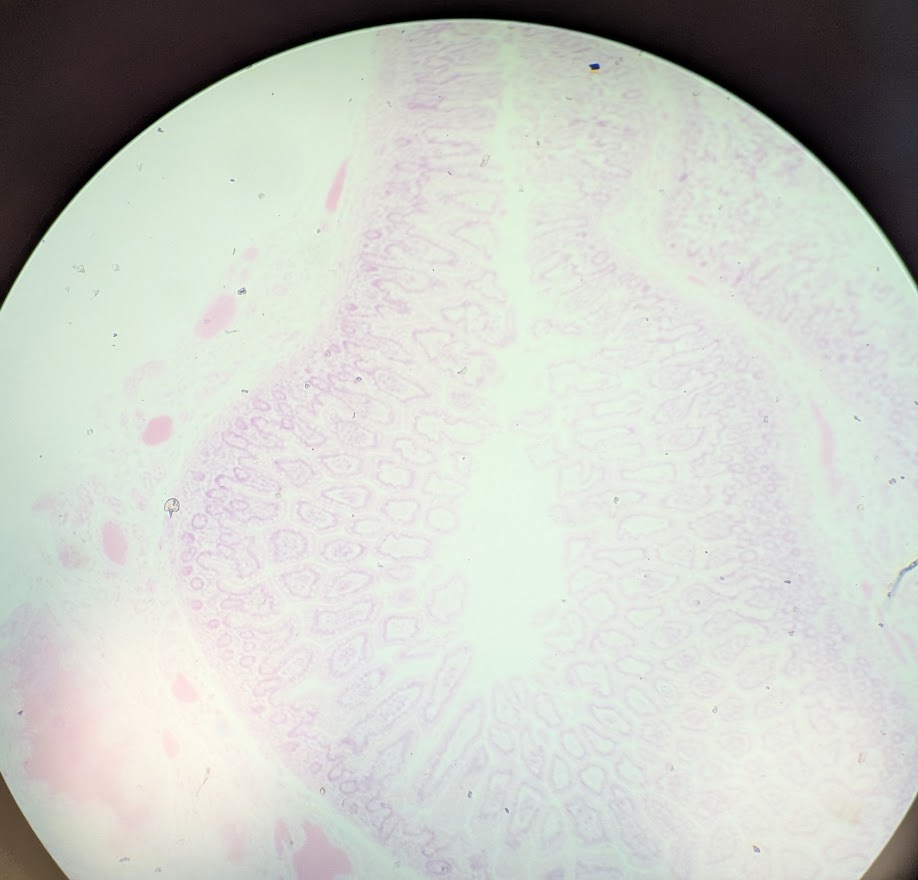 <p>Where in the body is this</p>