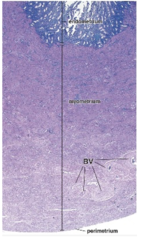 <p>What are the three layers of the uterine wall?</p>