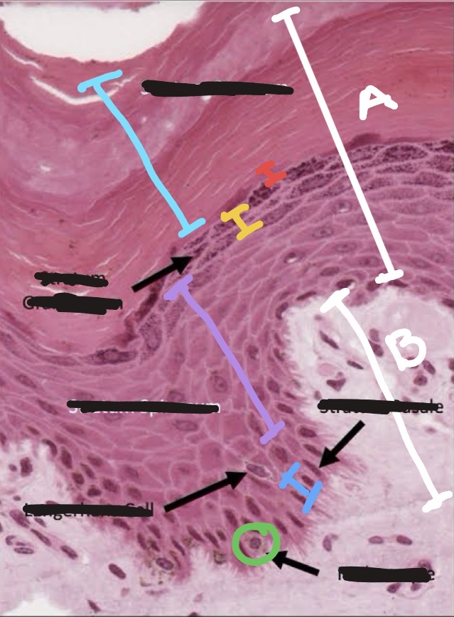 <p>what skin level is the red highlighted area?</p>