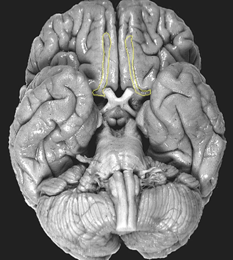<p>What is the area highlighted called?</p>