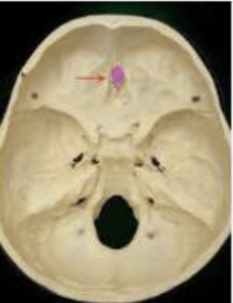 <p>what is the boney projection indicated by the arrow </p>