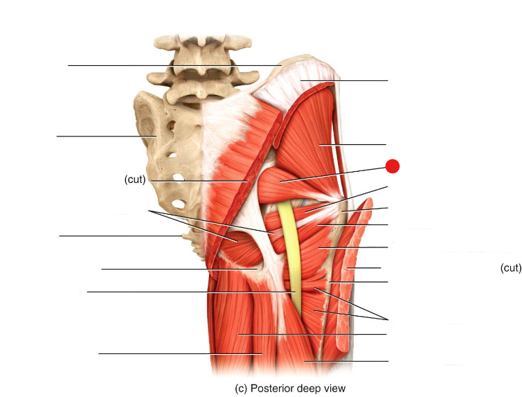 <p>Identify the structure pinned</p>