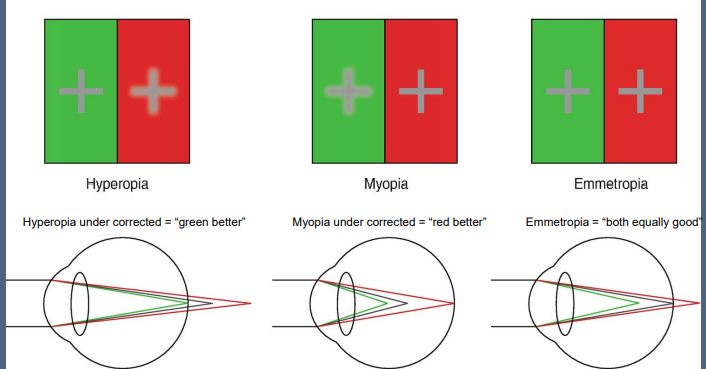 <ul><li><p>Myopes → Red is better</p></li><li><p>Hyperopes → Green is better</p></li><li><p>Emmetropes → Both equal</p></li></ul><p></p>