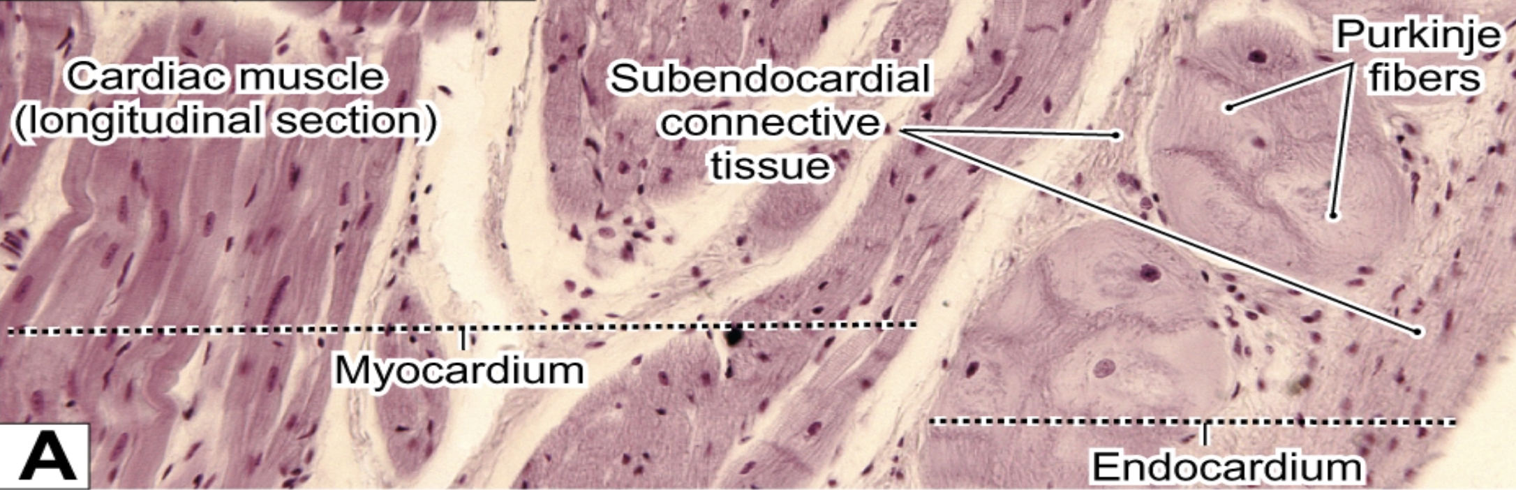 <p>Purkinje fibers</p>