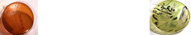 <p>There are <strong>2</strong> <strong>microorganisms </strong>that show <strong>no color on EMB plates</strong> making them <strong>lactose non-fermenters. </strong>They also form <strong>black precipitate on HE plates </strong>due to <strong>H2S production,</strong> which 2 microorganisms are these?</p>
