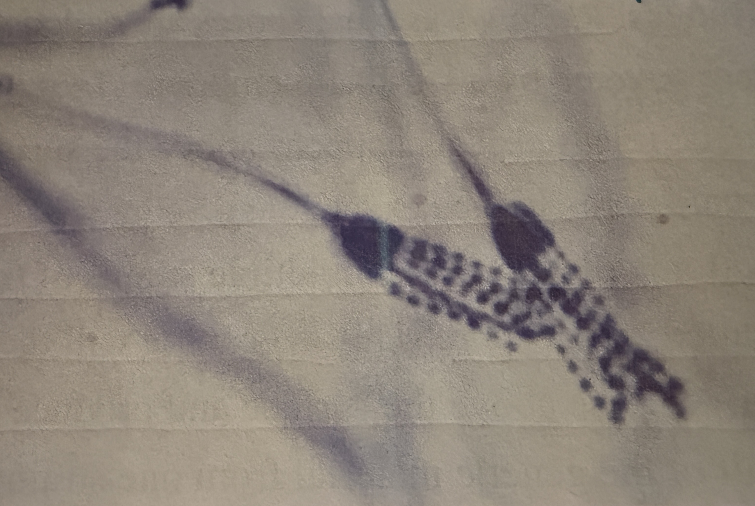 <p>Penicillium notatum </p>