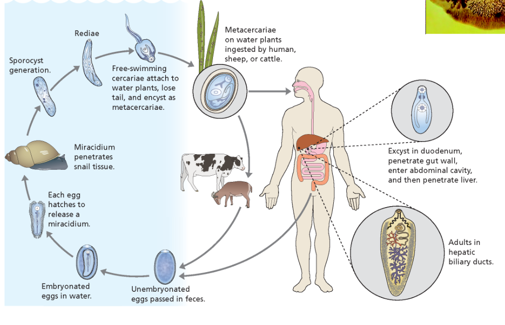 <p>trematode where the number of parasites determines the pathology. It damages the bile ducts causing jaundice, liver failure, and pancreatitis. </p>
