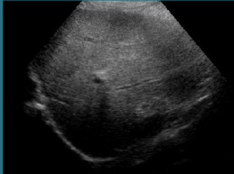 <p>what can be said about the parenchyma of this liver</p>