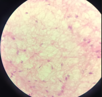 <p>Hypoderma - HE</p><ul><li><p>no blood vessels inside</p></li><li><p>example of loose connective tissue </p></li><li><p>loose connective tissues built of collagen and elastic fibers</p></li><li><p>Collagen fibers: big fibers and cells attach to them</p></li><li><p>elastic fibers: thin and smaller, cells don’t attach to them ( because they change composition, stretched and relaxed)</p></li><li><p>Cells that attach to collagen fibers are called Adherent oblique cells (fibroblast/fibrocytes)</p></li><li><p>fibroblasts - cells which produce the whole component of extracellular matrix (fibers, collagen, ground substances)</p></li><li><p>Defense cells - not attach, but moving, come from blood vessels (granulocytes, macrophages, lipocytes)</p></li></ul><p></p>