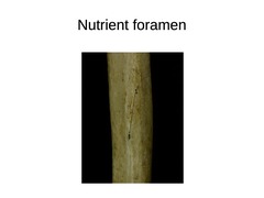 <p>small canal passing through the periosteum and other layers to get into the medulla</p>