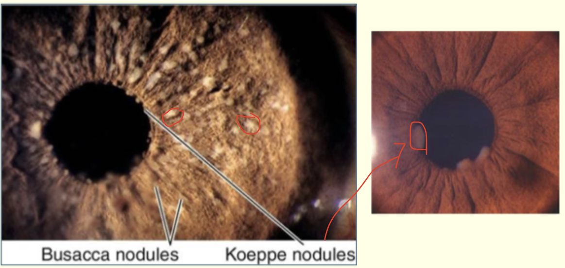<p>Describe this image and give diagnosis </p>