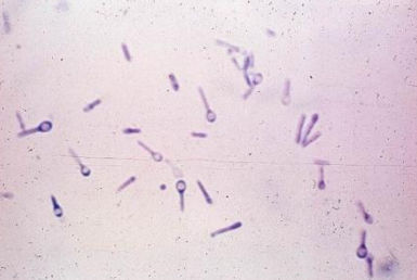 <p>PATHOGENIC BACTERIA:</p>