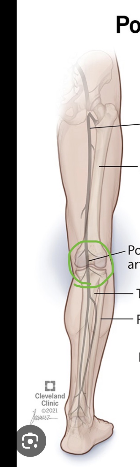 <p><span><span>a continuation of the </span></span><a target="_blank" rel="noopener noreferrer nofollow" class="link" href="chatgpt://generic-entity?number=0" data-prevent-progress="true"><span><u><span>femoral artery</span></u></span></a><span><span> that runs behind the knee through the popliteal region. It supplies blood to the knee joint, surrounding muscles, and lower leg, and eventually branches into the anterior and posterior tibial arteries.</span></span></p>