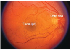 <p>What is visible with ophthalmoscopy is called the 'optic disc' or 'optic nerve head'</p>