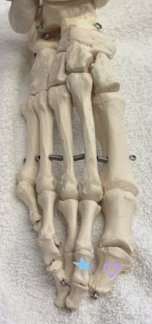 <p>Blue star: What is this bone? What muscle inserts here and what is its function?</p><p>Purple heart: What is this bone? What two muscles insert here?</p>