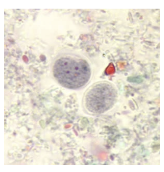 <p>-No peripheral chromatin</p><p>-4 nuclei with karysomes</p>