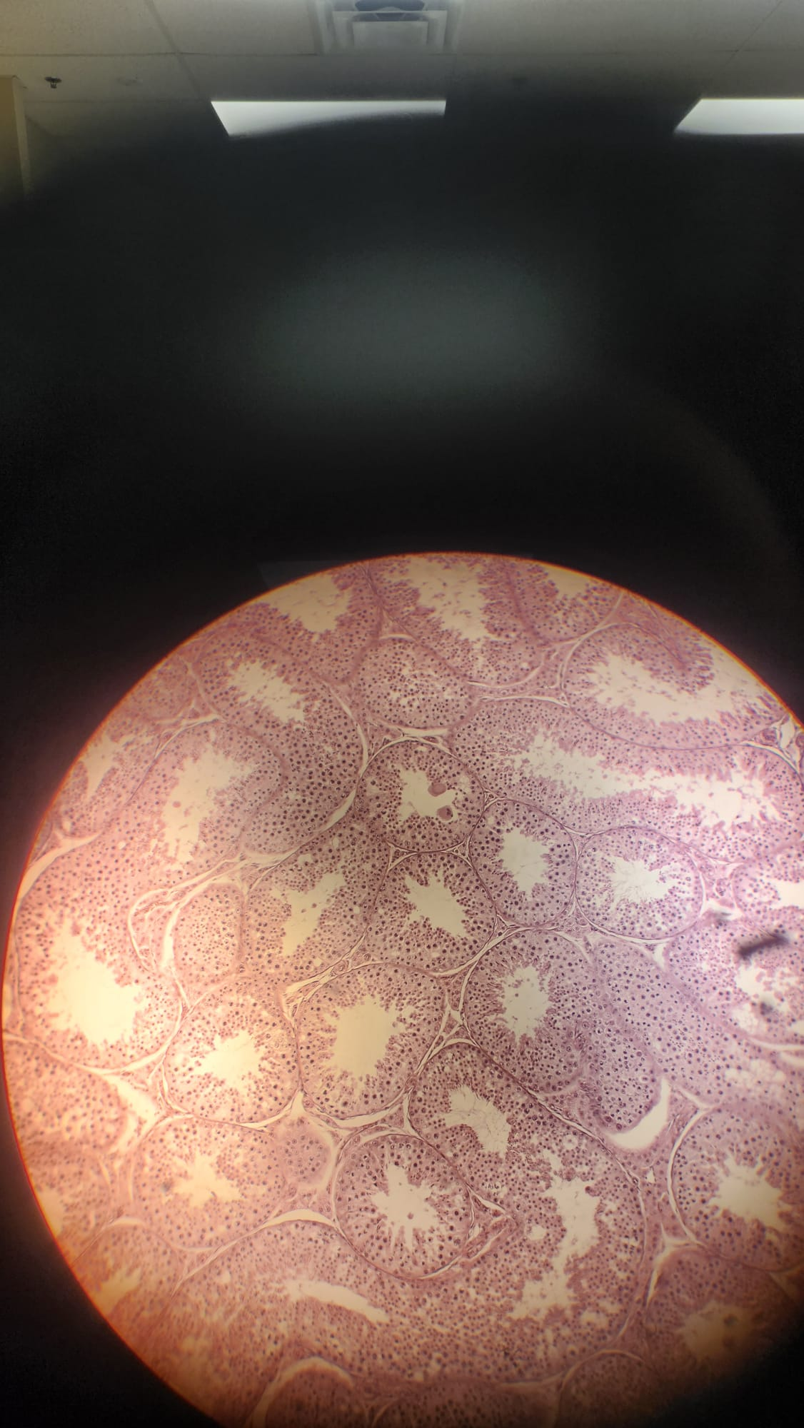 <p>Which structures are seen here?</p>