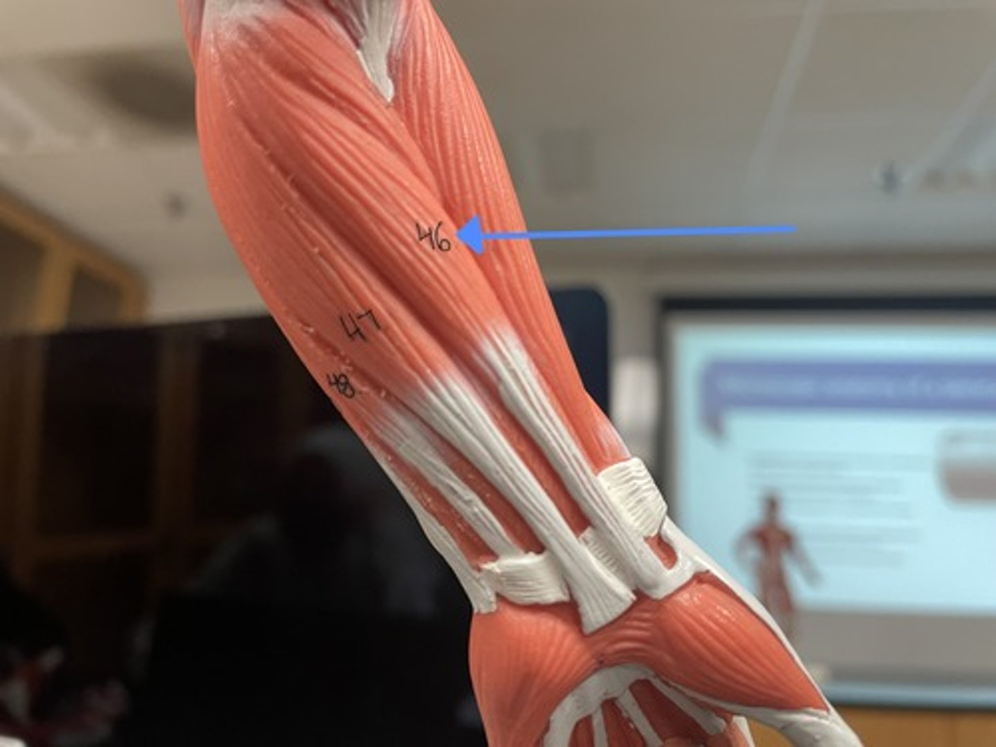 <p>flexor carpi radialis</p><p>origin:</p><p>insertion:</p><p>action:</p>