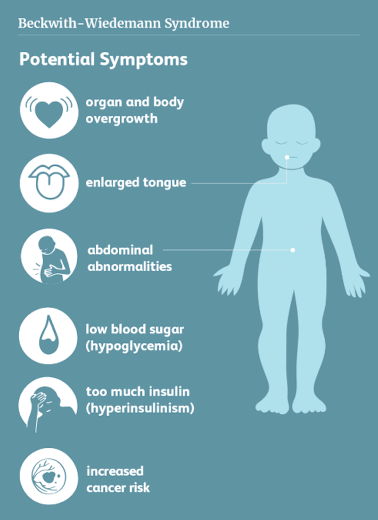 <ul><li><p>rare syndrome results in a grossly large fetus</p></li><li><p>characterized by:</p><ul><li><p><span style="color: red;">macroglossia</span></p></li><li><p>omphalocele</p></li><li><p>embryonic tumors</p></li><li><p><span style="color: red;">visceromegaly</span></p></li><li><p><span style="color: red;">macrosomia</span></p></li></ul></li><li><p>associated with hepatic, renal, and adrenal tumors; also ear creases</p></li></ul><p></p>
