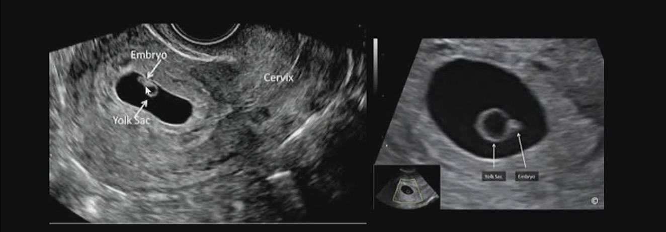 <p>How can we tell if </p>