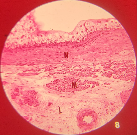 term image