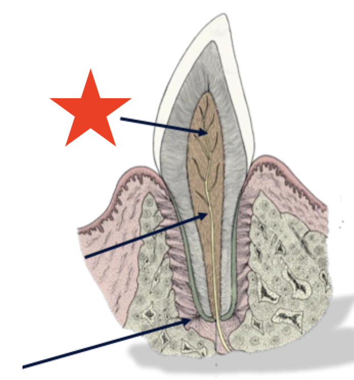 <p>What part of the tooth is indicated by the star?</p>