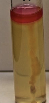 <p>What test is this and Interpret result.</p>