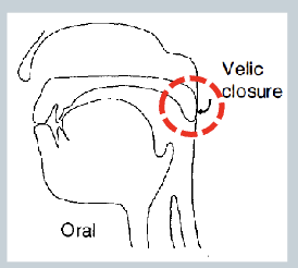 <p>When the <strong>velum is raised</strong>, <strong>blocking</strong> <strong>airflow through the nasal passages</strong>, oral sounds are produced</p><ul><li><p>/p b k t d g/</p></li></ul><p></p>
