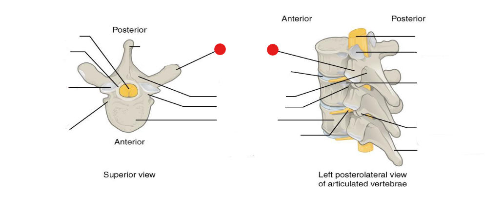 <p>Identify the structure pinned</p>