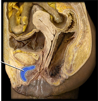 <p>what structure is highlighted?</p>