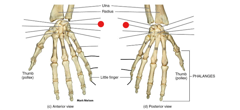 <p>Identify the structure pinned</p>